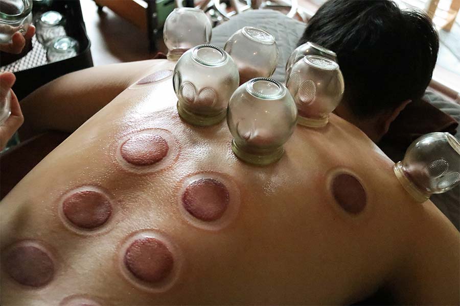 s-cupping